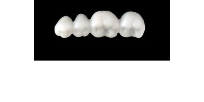 Cod.S1LOWER RIGHT : 15x  posterior solid (not hollow) wax bridges, LARGE , (44-47) , with precarved occlusion to Cod.S1UPPER RIGHT,and compatible to Cod.E1LOWER RIGHT (hollow), (44-47)